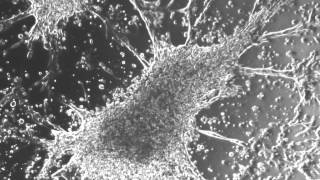 Beating cardiomyocytes.