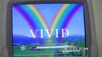 GE Vivid 7