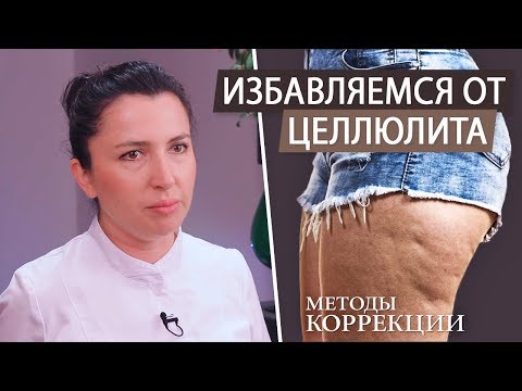 Борьба с целлюлитом на попе и ногах в домашних условиях. Как избавиться от целлюлита.