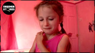 Luciana’s Fight With FOP: X-Ray