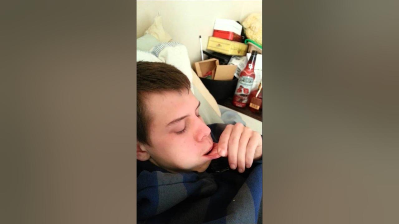 Get the gauze out.. wisdom teeth removal YouTube