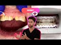 DENTIST REACTS TO VIRAL TEETH TRANSFORMATIONS