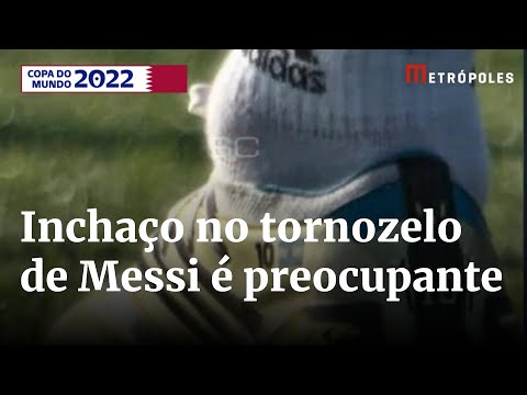 Alerta: o tornozelo de Messi está “uma bola” e não desincha | Boletim Copa 2º