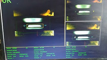 Delta machine vision system