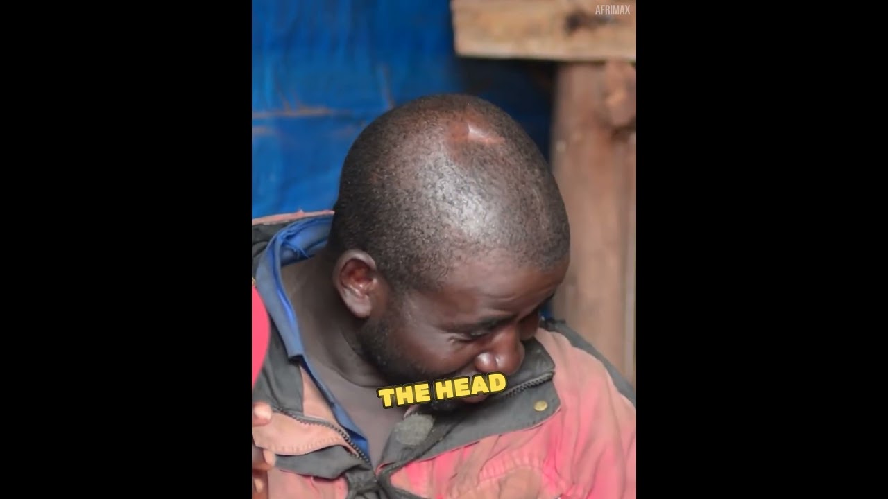 His Father Cut Off His Legs