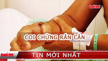 Mùa mưa, coi chừng bị rắn cắn
