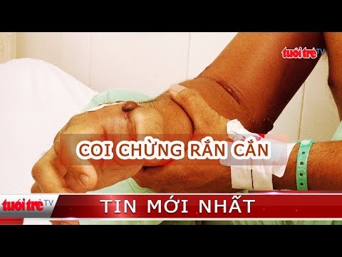 Mùa mưa, coi chừng bị rắn cắn