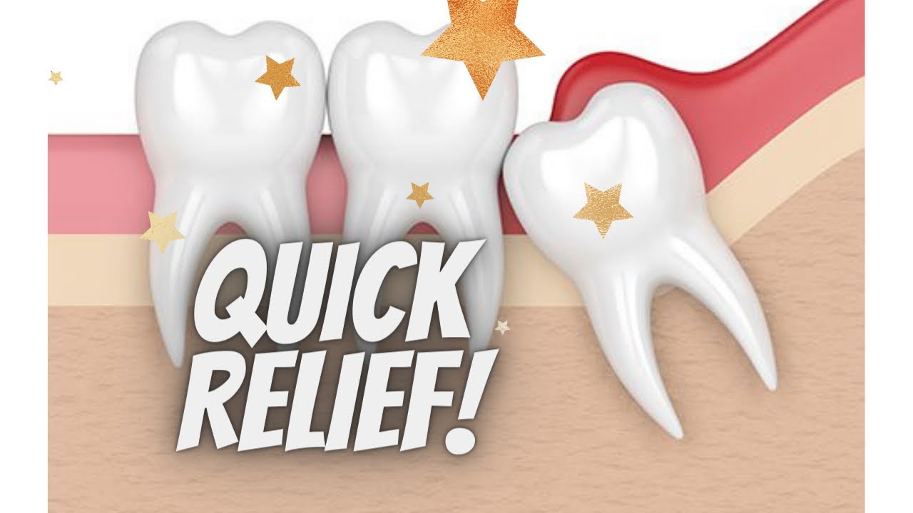 Wisdom Tooth Gum Pain Swelling Pericoronitis Gum Swelling QUICK