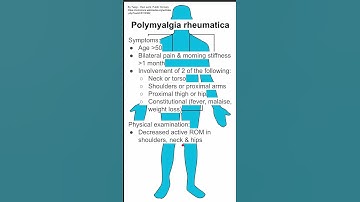 Polymyalgia rheumatica
