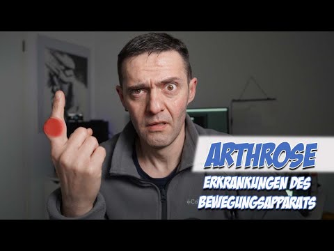 Arthrose | Erkrankungen des Bewegungsapparats | Pflege Kanal