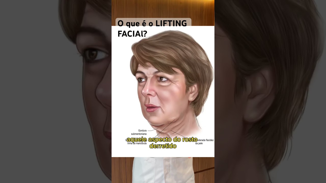 O que é o Lifting Facial?  Saiba mais sobre a cirurgia plástica do rosto… 