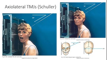Radiographic Positioning of the TMJs