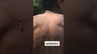 What Happens During Vitamin B5 Deficiency