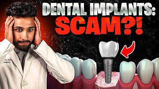 Dental Implants: A Dental Scam? (Shocking Truth Revealed)