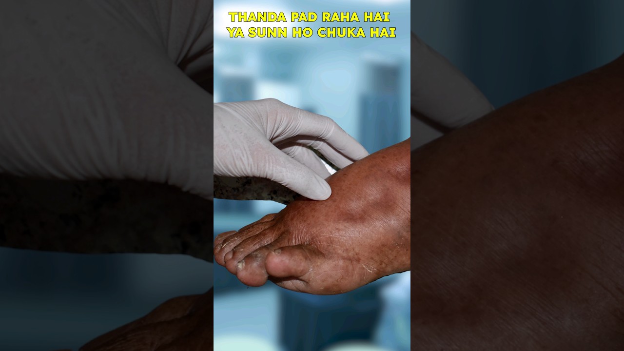 How to Identify Symptoms of Gangrene | Diabetic Foot | Gangrene | Dr. Gaurav Gangwani
