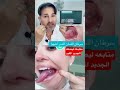 قرحات اللسان تتحرل الى سرط ن إحذروا منها