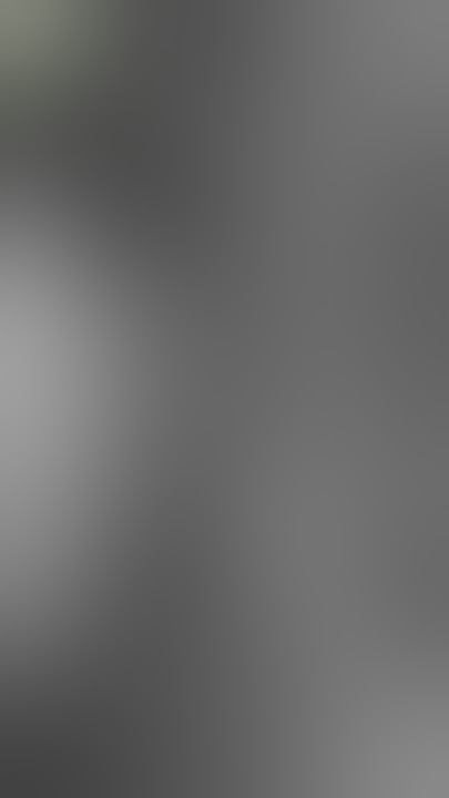 MTF (Male to Female) Sex Reassignment Vagina Creation Surgery with Sigmoid Colon | Vagina Dilation