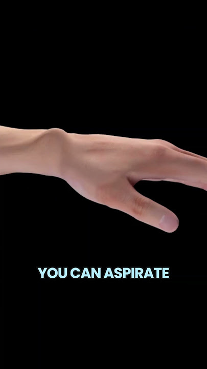 Bible Bump Cyst Popping - Would you do it? #shroud