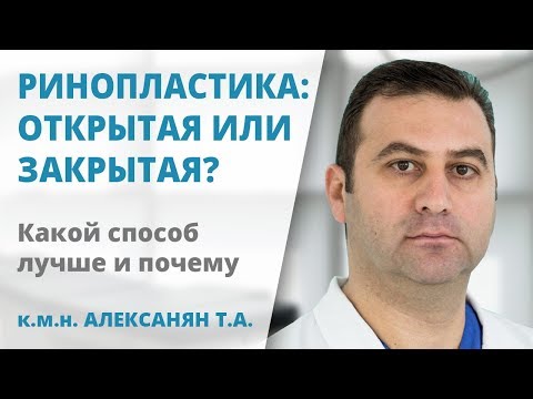 Открытая или закрытая ринопластика – какой способ лучше?