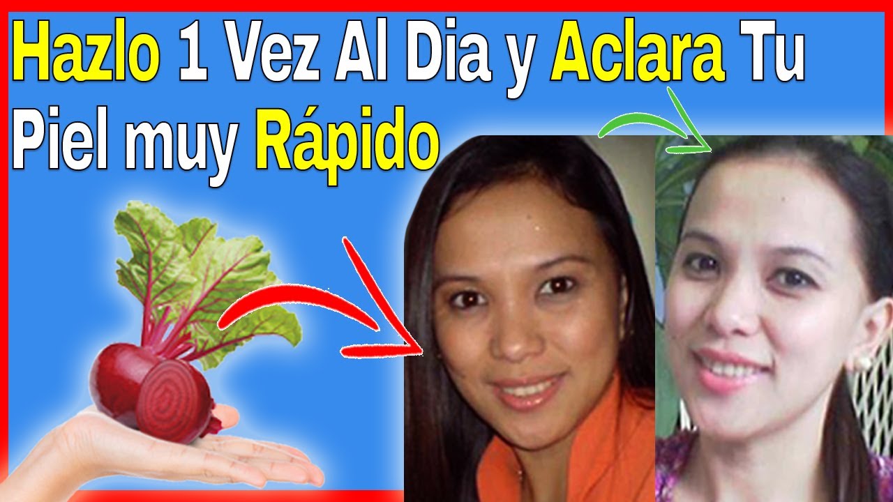 Los Dermatologos no Quieren que lo Sepas, Aclara la Piel Usando Estos Ingredientes remedios naturales para la artritis