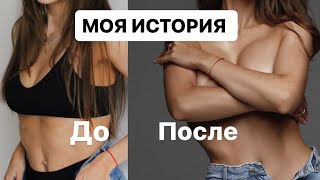 МАММОПЛАСТИКА И АБДОМИНОПЛАСТИКА🍒 Моя история, мой опыт, моё восстановление