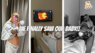 WE FINALLY SAW OUR BABY!!🤰🏼