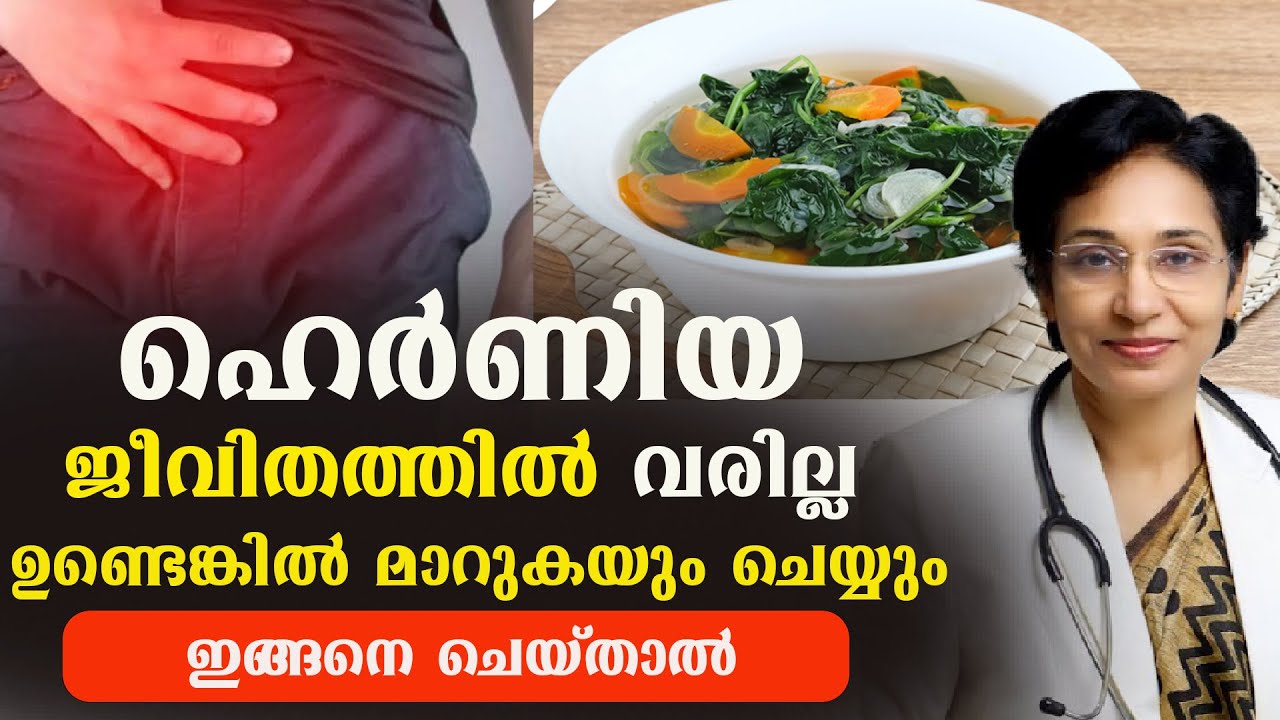 ഹെർണിയ ജീവിതത്തിൽ വരില്ല ഇന്ടെങ്കിൽ മാറുകയും ചെയ്യും ഇങ്ങനെ ചെയ്താൽ /Dr Jolly Thomson