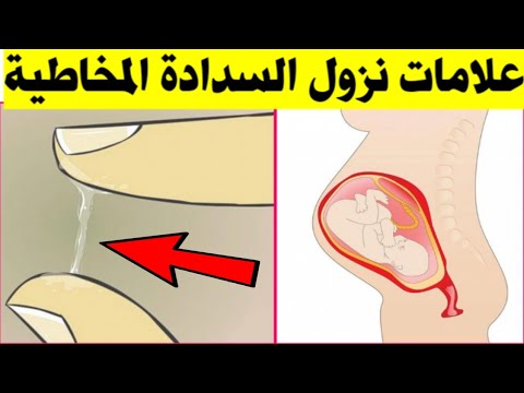 هذا هو شكل السدادة المخاطية وعلامات تخبرك أنها نزلت منك واقتربت الولادة ان شاء الله