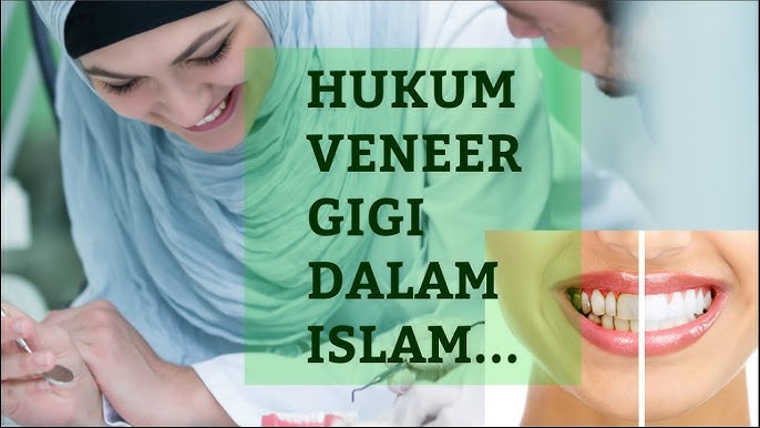 Apa Hukum Veneer Gigi Dalam Islam Apa Hukum Veneer Gigi Dalam Islam
