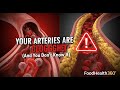 “Blocked Arteries Explained | The Silent Killer Behind Heart Attacks”