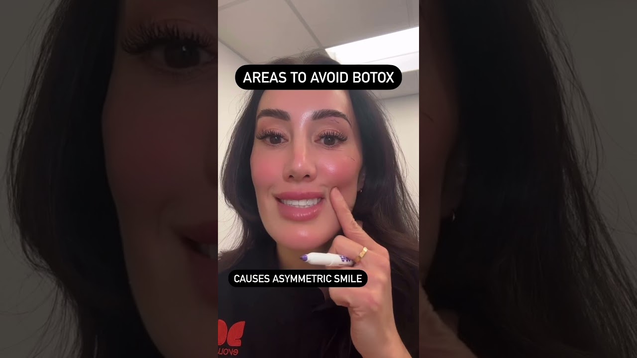 botox areas to avoid. be precise