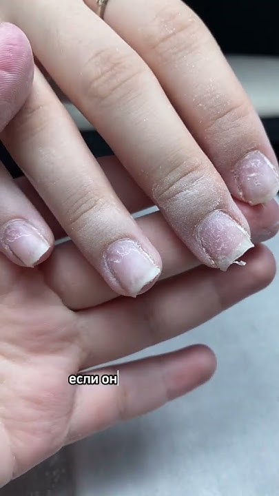 отслойки от кутикулы- что делать? #nails #мастер #ногти - YouTube