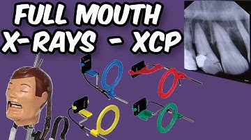 Full Mouth X-Rays - XCP Tips and Tricks