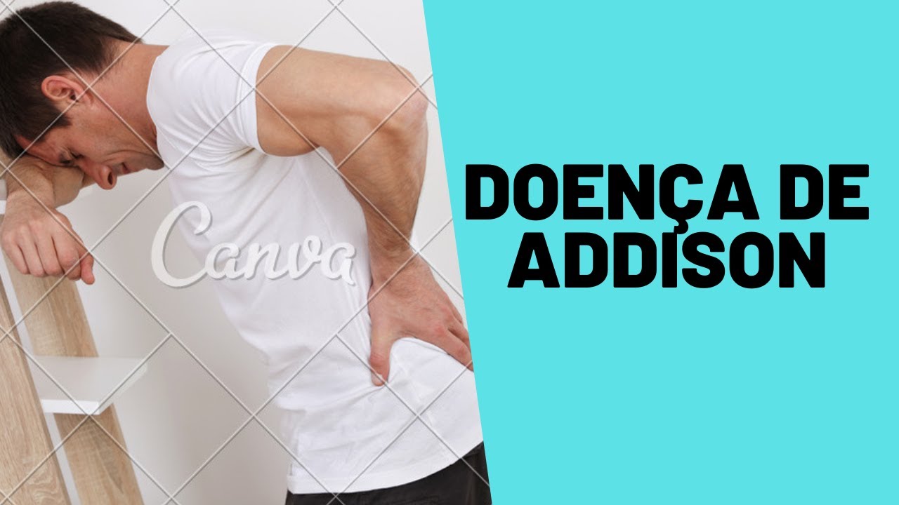 Doença de Addison - YouTube