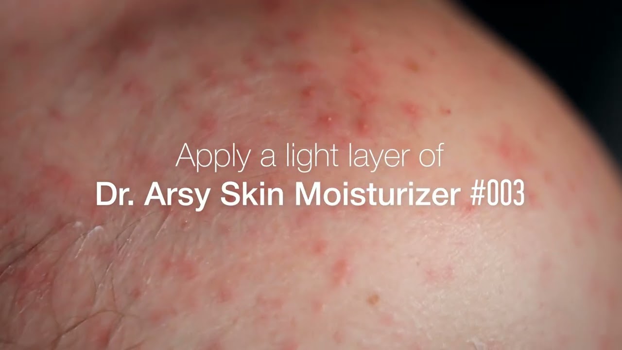 Recommended by Pharmacists | Trusted by Skin Experts