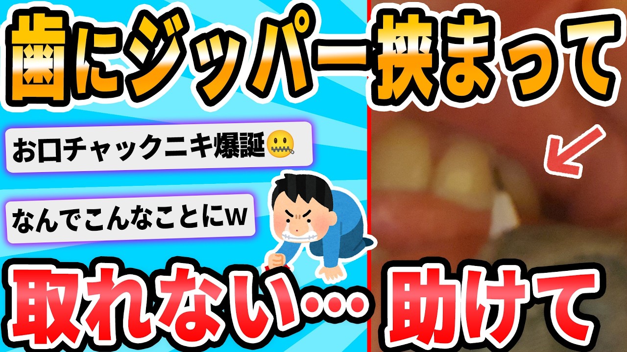【2ch面白いスレ】ワイの歯の隙間にジッパーが挟まり抜けなくなる