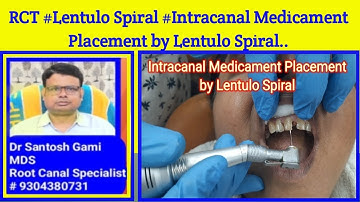 RCT # Lentulo Spiral # Intracanal Medicament Placement by Lentulo Spiral...-Copy