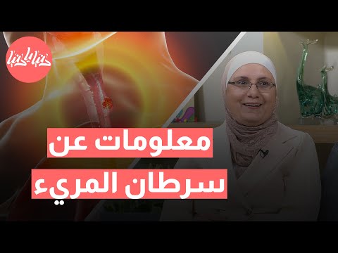 كيف تكتشف سرطان المريء مبكر ا أبرز الأعراض والعلامات