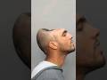 This man lost HALF his brain but miraculously survived #shorts