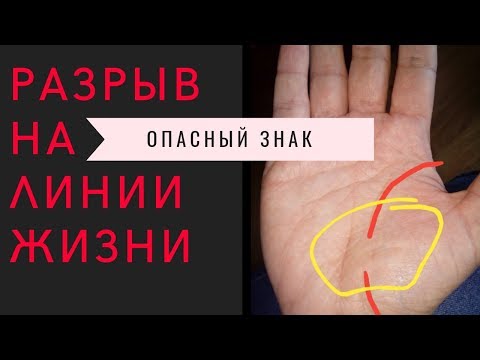 Разрыв на линии жизни - в  чем опасность? Хиромантия. Опасные знаки на руке