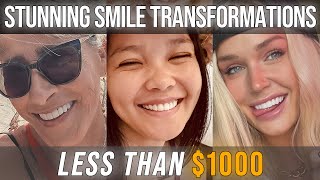 Amazing Smile Makeovers for Less Than $1,000!