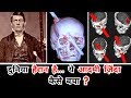 इस आदमी के दिमाग  से 4 फुट लम्बी लोहे की ROD गुज़री. ऐसे ये ज़िंदा बचा (Phineas Gage Case Study)