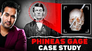 Phineas Gage Case Study - The Man Who Had an Iron Rod Pass through Head