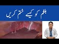 How To Get Rid Of Respiratory Mucus (Phlegm) Urdu Hind - Balgam Khatam Karne Ka Tarika - Irfan Azeem