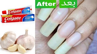 How to GROW YOUR NAILS FAST IN 3 DAYS !!! 100% effective