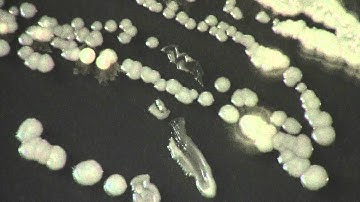 Capturing Wild Yeast Part III - Identifying Usable Yeasts