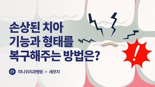 [손상된 치아] 손상된 치아의 기능과 형태를 복구해주는 방법은?  | 세모지X미니쉬치과병원