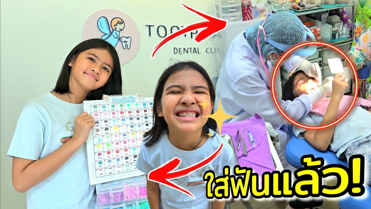 ออมเล็ต ใส่อุปกรณ์จัดฟันแล้ว จะออกมายังไง ??