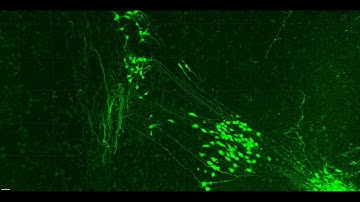Retrograde labeling of trigeminal sensory and motor neurons in E10.5 mouse.