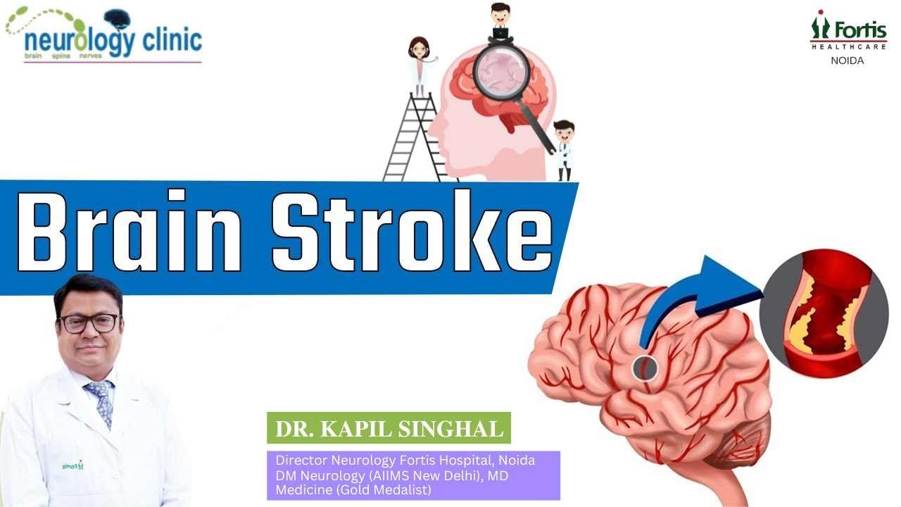brain-stroke-kya-hota-hai-aur-kyu-hota-hai-brain-stroke-dr-kapil